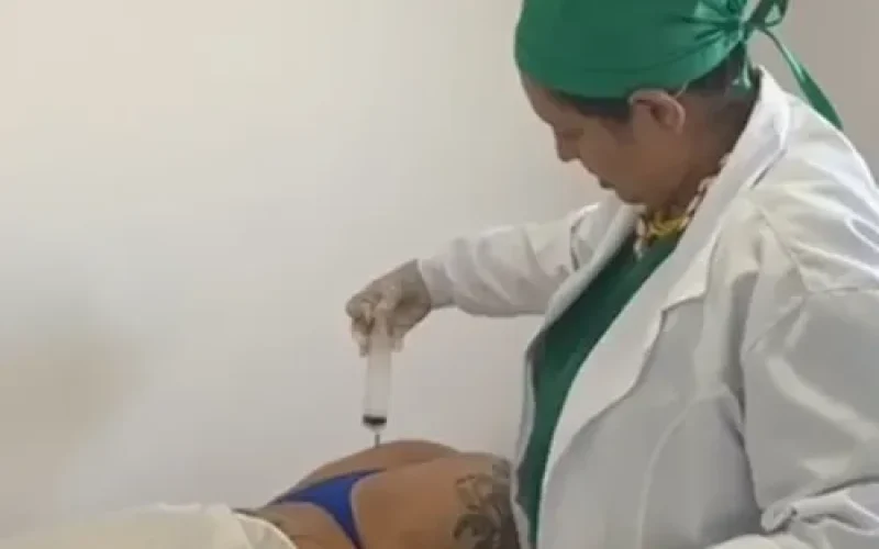 Falsa médica é presa, suspeita de aplicar silicone de construção em harmonização de glúteos