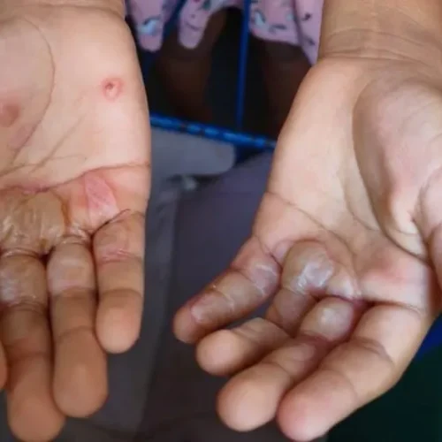 Paraíba tem a 2ª maior taxa de denúncias de violência contra crianças e adolescentes no Nordeste