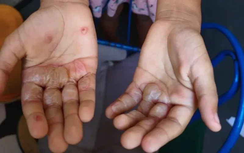 Paraíba tem a 2ª maior taxa de denúncias de violência contra crianças e adolescentes no Nordeste